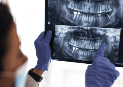 Oral Surgery and Dental Implants